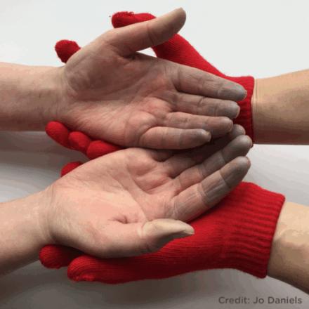 gloved hands holding hands with blue fingers from a Raynaud's attack